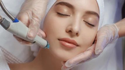 Chemical Peels vs. Lasers: Which Skin Resurfacing Method is Best for You?